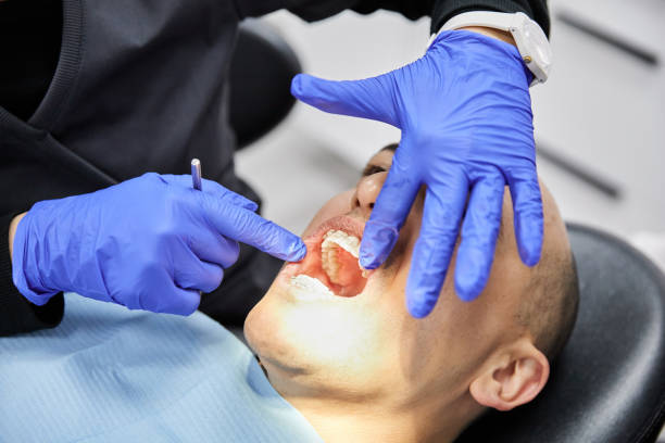 Best Emergency Dentist for Lost Fillings or Crowns in Elwood, IN